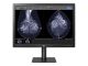 LG MED 31IN 12MP DIAG DISP ALLMODALITIES+BREAST CALIBRATE SOFT