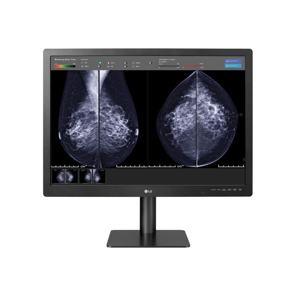 LG MED 31IN 12MP DIAG DISP ALLMODALITIES+BREAST CALIBRATE SOFT